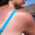 12 Pantry Items That Can Soothe Your Sunburn