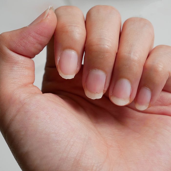 fingernail lack of nutrients and do not make nail not shape and not care, this image can be use for health care concept
